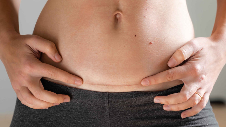 C-sections: All you need to know