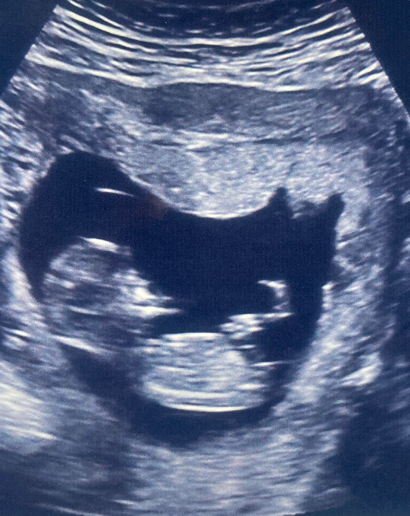 My pregnancy diary: part one