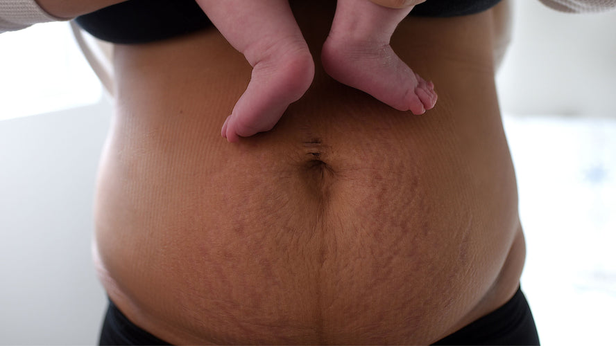 Postpartum: Things they never told you