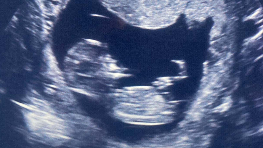 My pregnancy diary: part one